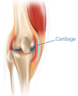 Cartilage Cross-section